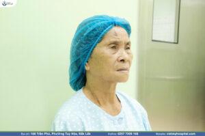 Phẫu thuật đục thủy tinh thể